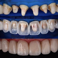 Zahnärztin Dentist Estetik Diş Hekimi Derya Perçin