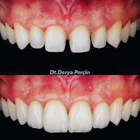 Zahnärztin Dentist Estetik Diş Hekimi Derya Perçin