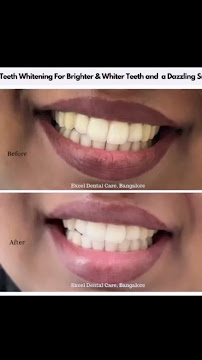 Excel Dental Care
