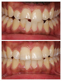 All Care Dental Centre Indiranagar