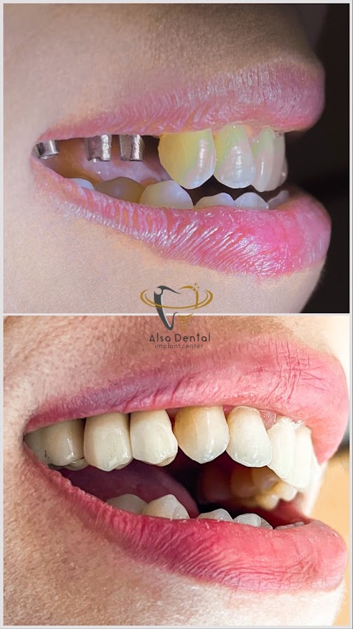 Klinik Gigi dan Bedah Mulut - Alsa Dental Bali - dental clinic in Bali, Indonesia