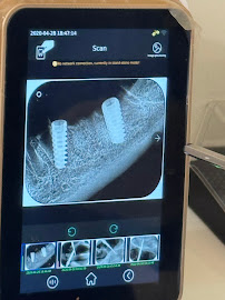 Dr. Inchara Vadegadde -iLUMNA+ Healthcare- Best dental clinic Bangalore, Jayanagar| Dental implant & Invisalign