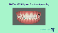 Dr. Inchara Vadegadde -iLUMNA+ Healthcare- Best dental clinic Bangalore, Jayanagar| Dental implant & Invisalign