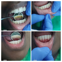 Root Care Dental Clinic