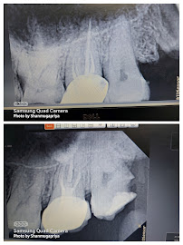Root Care Dental Clinic