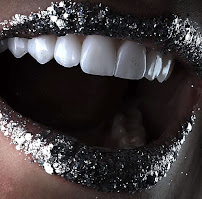 TurSmile Antalya - ( Dental Implants, Veneers & Turkey Teeth)