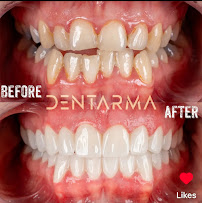 DentArma Turkey Dental Clinic