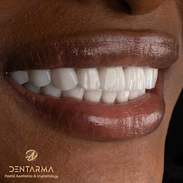 DentArma Turkey Dental Clinic