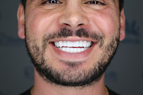 Venedik Dental Clinic Turkey – Dental Implants & Veneers