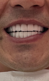 Mevsim Diş Ağız ve Diş Sağlığı | Antalya Diş Hekimi | İmplant | Zirkonyum | Hollywood Smile | Beyazlatma