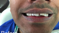 Impressions Dental Specialities | Best Dental Clinic in Bengaluru | 5★ Rating on Practo