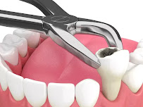 JAIN DENTAL CENTRE | Painless Dentistry | Specialist Implant & Multispeciality Clinic