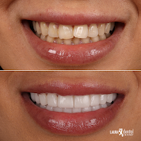 Laura Dental Center Turkey