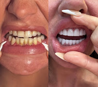 Laura Dental Center Turkey