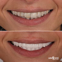 Laura Dental Center Turkey