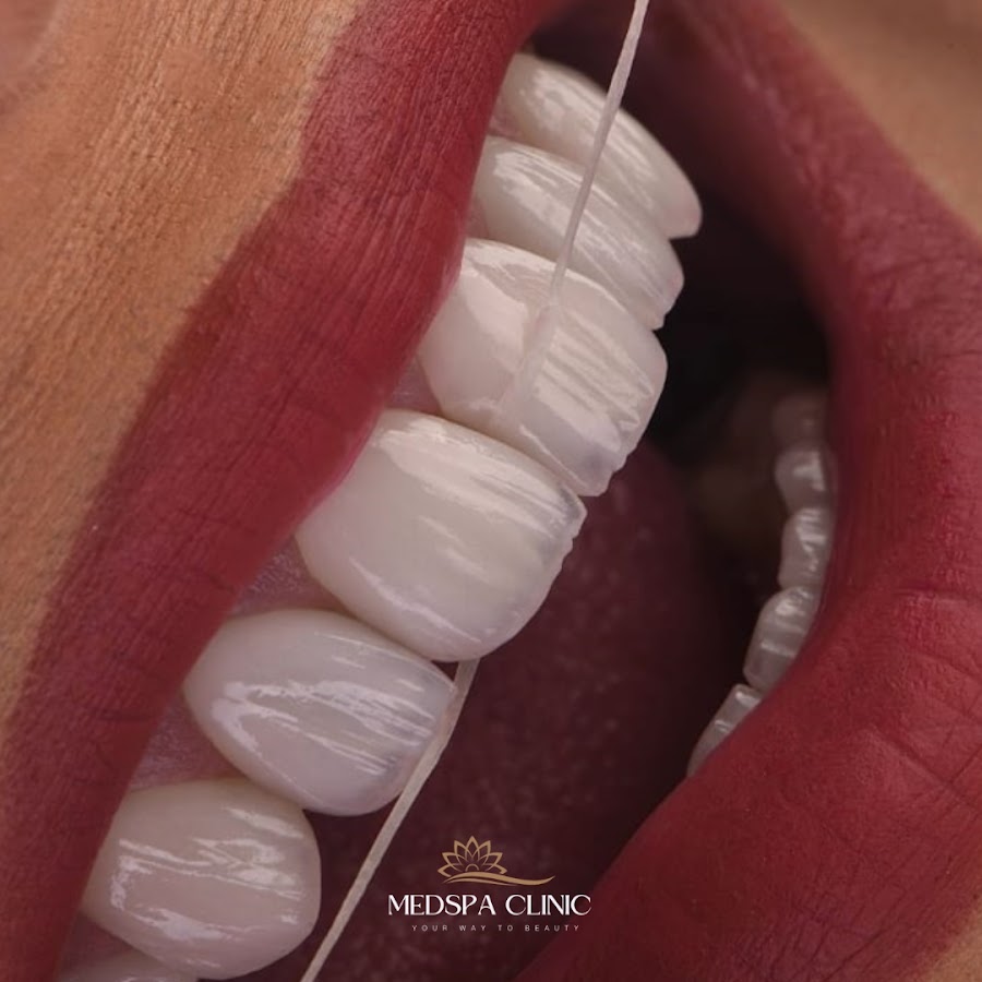 Medspa Clinic - Dental Implants, Hollywood smile, Dental clinic in Turkey