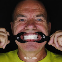 Medspa Clinic - Dental Implants, Hollywood smile, Dental clinic in Turkey
