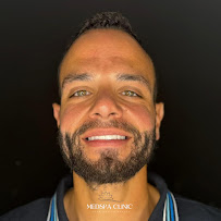 Medspa Clinic - Dental Implants, Hollywood smile, Dental clinic in Turkey