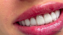 Medspa Clinic - Dental Implants, Hollywood smile, Dental clinic in Turkey