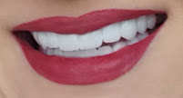 Medspa Clinic - Dental Implants, Hollywood smile, Dental clinic in Turkey