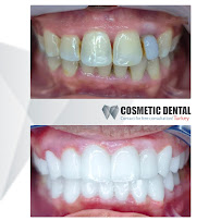 Cosmetic Dental Turkey