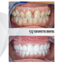Cosmetic Dental Turkey
