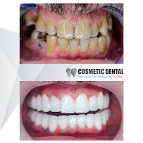 Cosmetic Dental Turkey