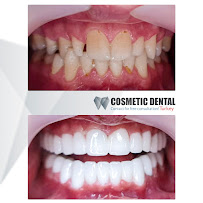Cosmetic Dental Turkey