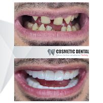 Cosmetic Dental Turkey