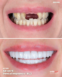 Smilepod Dental Clinic Turkey