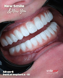 Smilepod Dental Clinic Turkey
