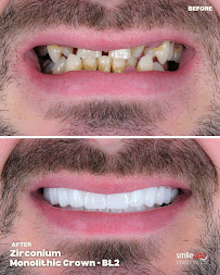 Smilepod Dental Clinic Turkey
