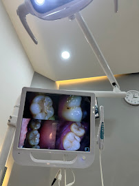 Klinik Gigi Joy Dental Teuku Umar Bali | Dokter Gigi Denpasar