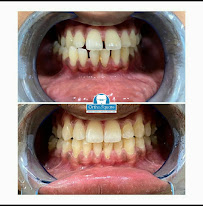 OrthoSquare Dental Clinic - Jakkasandra Extension, Bengaluru