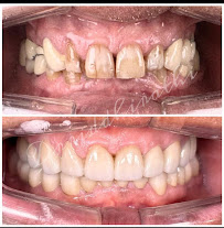 OrthoSquare Dental Clinic - Jakkasandra Extension, Bengaluru