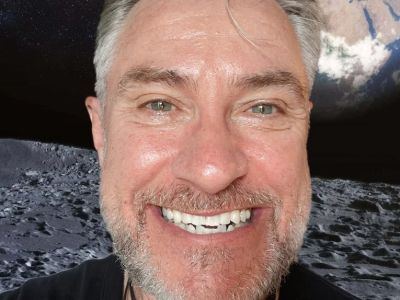 Bali Smile Teeth Whitening - Bali