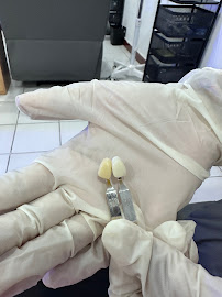 Bali Smile Teeth Whitening