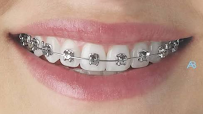 Dr. Laxmikanth S.M (MDS Orthodontics And Dentofacial Orthopedics)