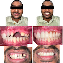 OrthoSquare Dental Clinic - New Tippasandra, Bengaluru