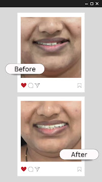 Align & Smile Orthodontic & Multispeciality Dental Clinic