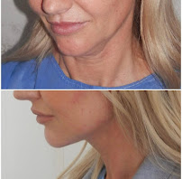 Klinik Europe AS l Plastic Surgery