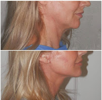 Klinik Europe AS l Plastic Surgery