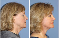 Klinik Europe AS l Plastic Surgery