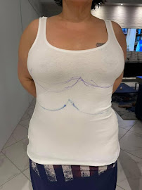 Klinik Europe AS l Plastic Surgery