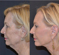 Klinik Europe AS l Plastic Surgery