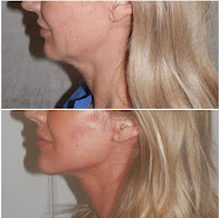 Klinik Europe AS l Plastic Surgery