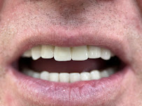 Luwi Dental Clinic Antalya