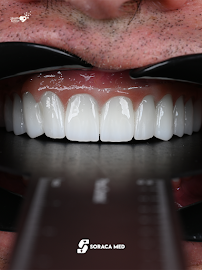 Soraca Med | Dental Treatment, Plastic Surgery and Hair Transplant