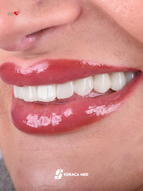 Soraca Med | Dental Treatment, Plastic Surgery and Hair Transplant
