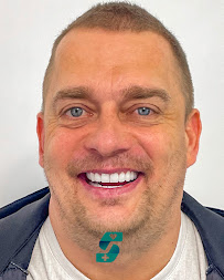 Soraca Med | Dental Treatment, Plastic Surgery and Hair Transplant